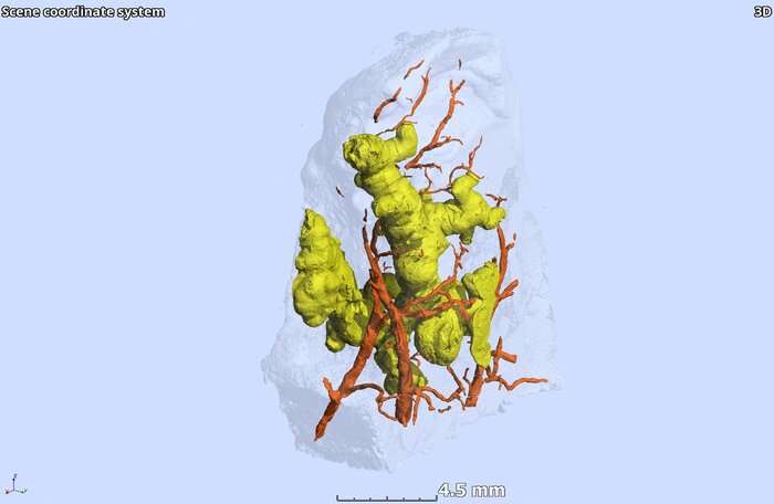 First 3-D view of TB granulomas alters paradigm of their shape and formation