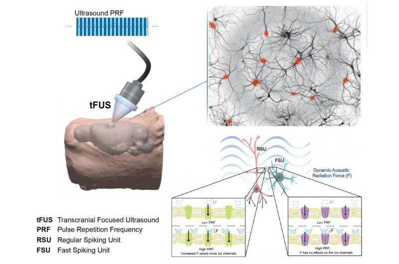 Focused ultrasound enables precise noninvasive therapy