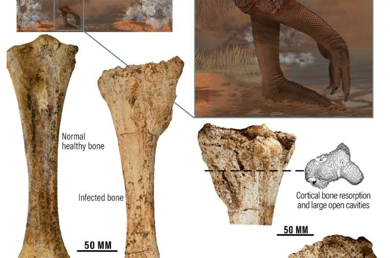 Fossil find reveals giant prehistoric ‘thunder birds’ were riddled with bone disease