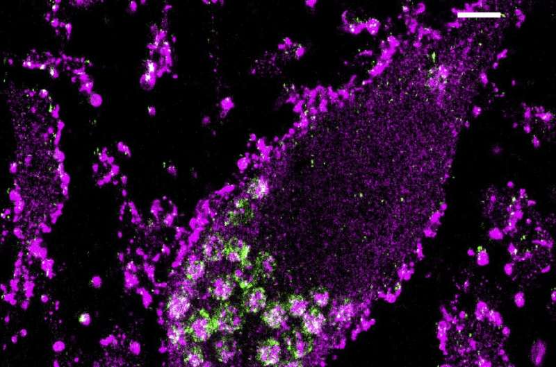 Full-genome CRISPR screen reveals surprising ways neurons survive oxidative stress