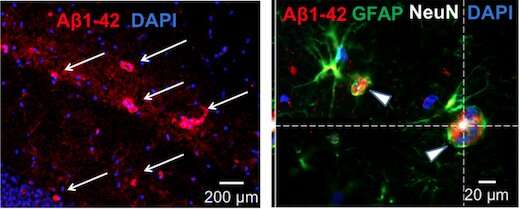 GluN3A knockout mouse: Alternative model for Alzheimer's neurodegeneration