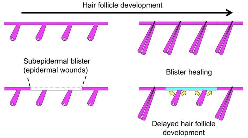 Hair follicles heal blisters at personal cost