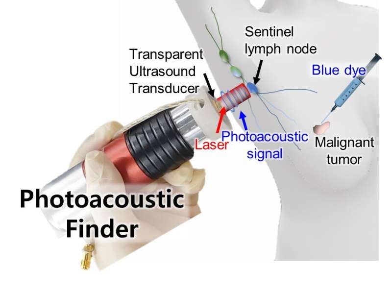Handheld photoacoustic finder for diagnosing cancer metastasis without radiation