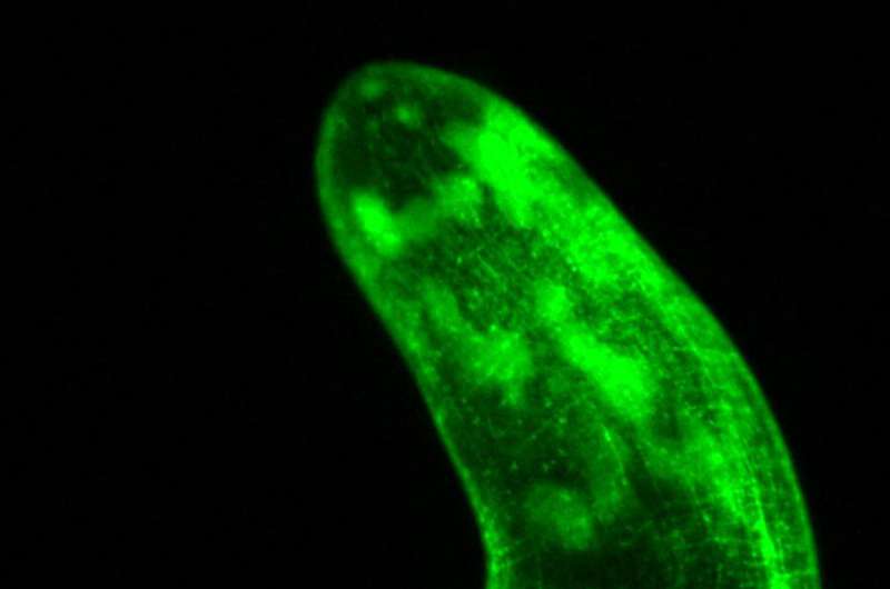 哈佛大学科学家把研究再生下一个层次,使三级豹蠕虫转基因