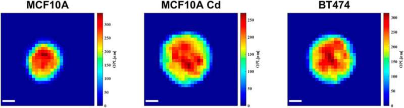 La holografía de alta velocidad de células detecta balizas físicas de enfermedad