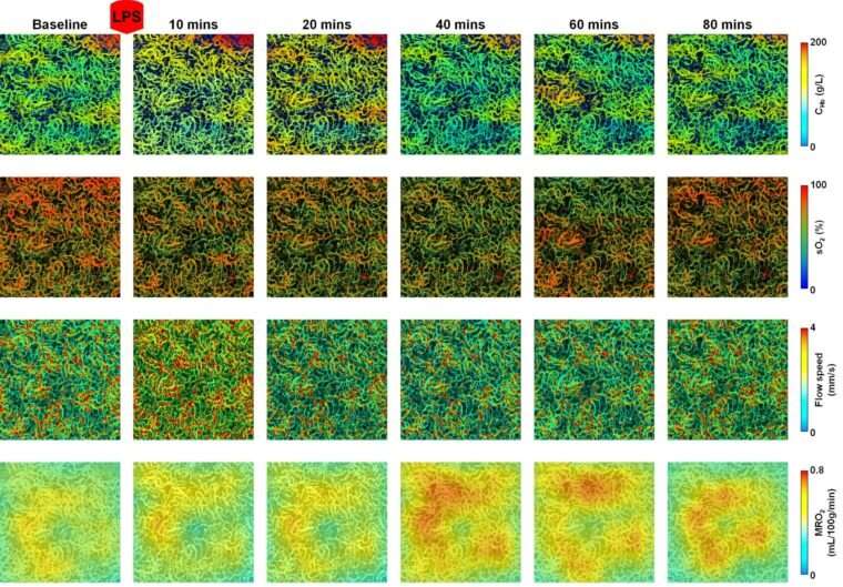High-tech imaging reveals blood, oxygen flow, energy metabolism in mouse kidneys