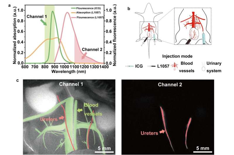 Hot-band absorption of Indocyanine Green for advanced anti-Stokes fluorescence bioimaging