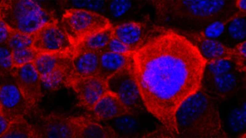 How pancreatic cancer cells dodge drug treatments