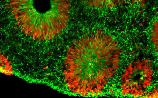 human brain organoids model fragile X syndrome more closely than mice