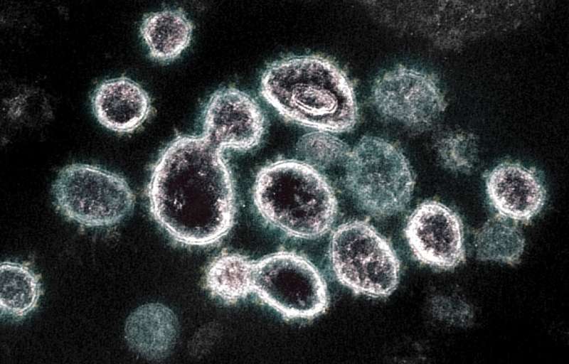 Image non datée d'observations au microscope du SARS-CoV-2, le virus causant le Covid-19, transmise par les Instituts nationaux 