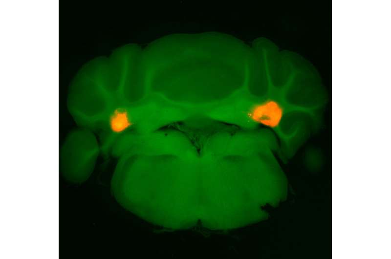 In the brain's cerebellum, a new target for suppressing hunger