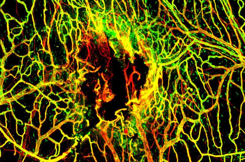 Infection hinders blood vessel repair following traumatic brain or cerebrovascular injuries