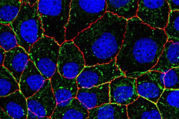 International research provides insight into how fibrosis can start and become so devastating in different body tissues