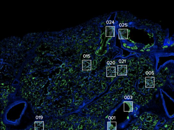 Large collaboration creates cell atlas of COVID-19 pathology