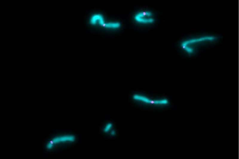 Linker histones tune the length and shape of chromosomes