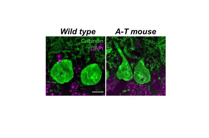 Lundquist Institute investigators develop a significant novel mouse model for A-T mutations