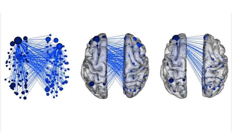 Machine learning reveals brain networks involved in child aggression