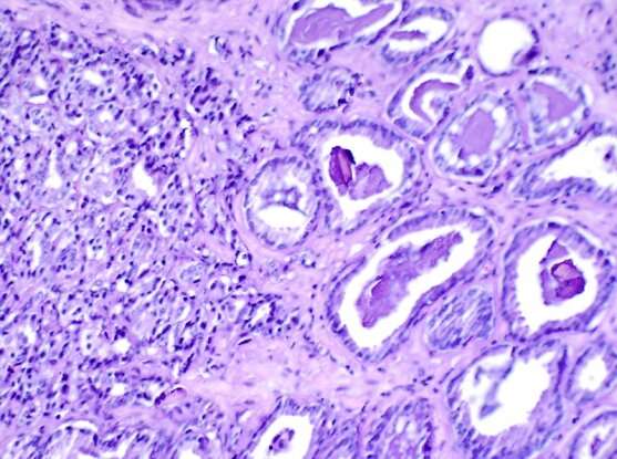 Machine learning tool could help oncologists make better treatment decisions