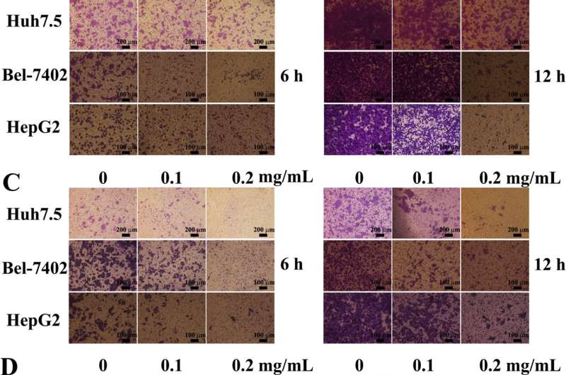 Marine bacterial exopolysaccharide EPS11 inhibits migration and invasion of liver cancer cells