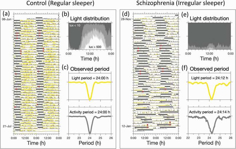 مدل ریاضی داده های نور و شبانه روزی زمان خواب را در افراد مبتلا به اسکیزوفرنی بهبود می بخشد