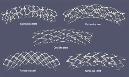Mathematical model reveals possible role of drug-eluting stents in artery re-closure