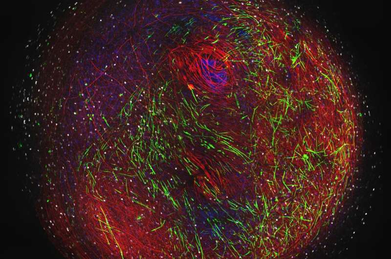Mini 3D brain models could speed up search for MS treatments