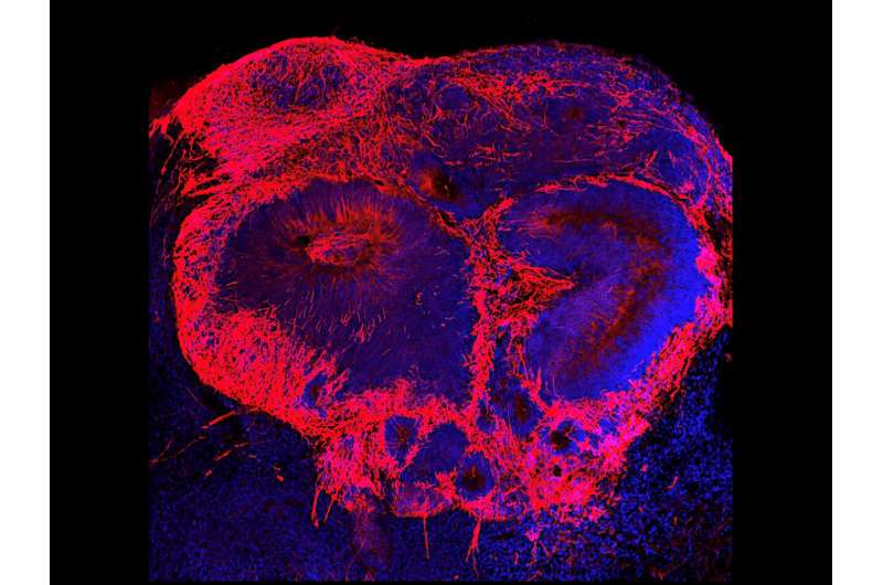 “Mini-brains” provide clues about early life origins of schizophrenia