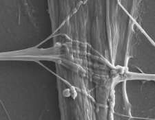 Miniaturized models of neuron-muscle interactions give insight in ALS