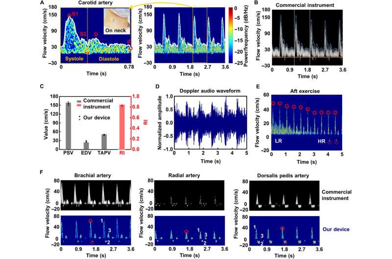 Monitoring blood flow velocity with a flexible Doppler Ultrasound device