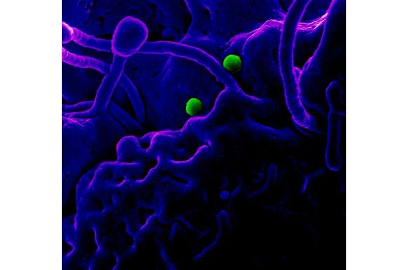 Monoclonal antibodies against MERS coronavirus show promise in phase 1 NIH-sponsored trial