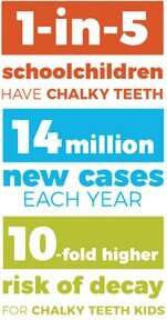 Mystery of children's 'chalky teeth' explained