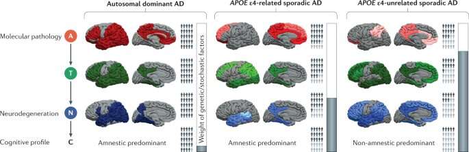 New framework for analyzing Alzheimer’s disease identifies not one form, but three