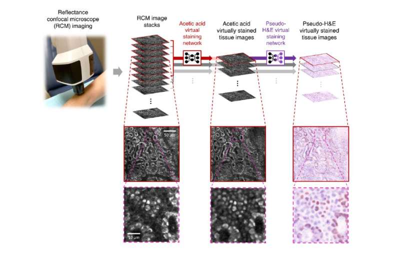 New imaging technology developed by UCLA research team may reduce need for skin biopsies