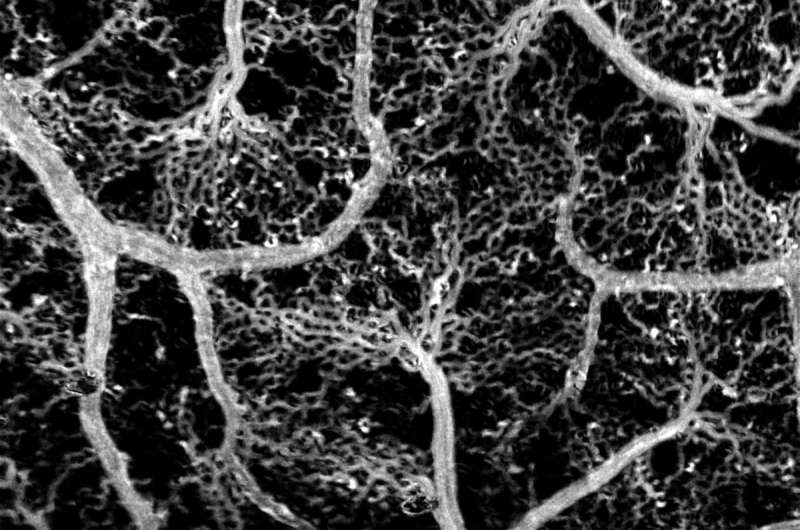 New method visualizes blood flow in the brain down to 1 blood cell