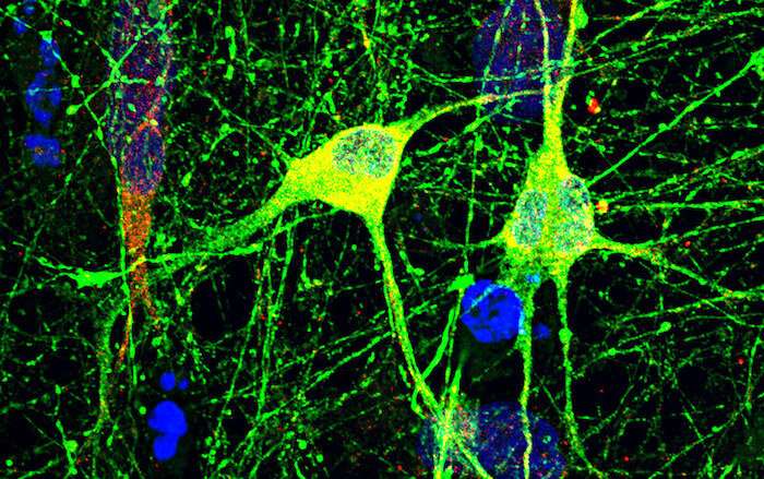 New technique yields potential treatment for a common cause of autism