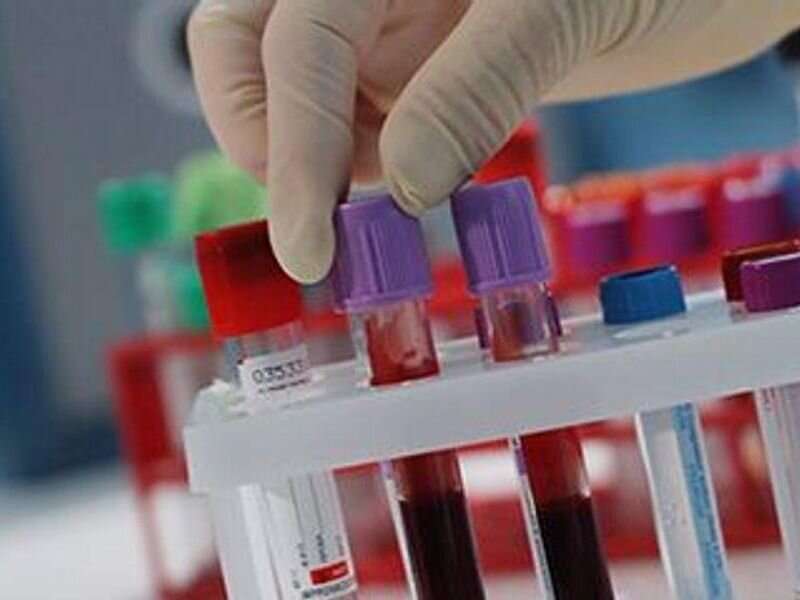 Analize de sange pentru depistarea cancerului