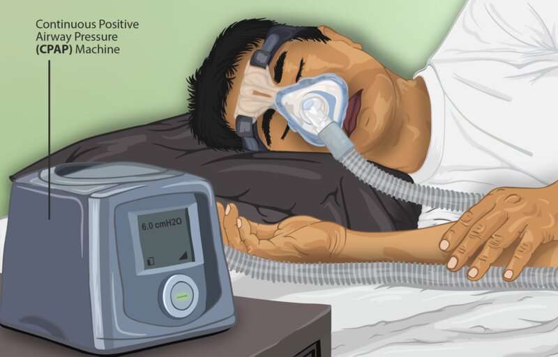 New tool fuses expert knowledge and deep learning features to detect sleep apnea