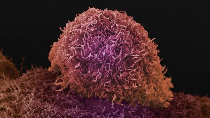 新的治疗方法可以唤醒对前列腺癌的免疫反应