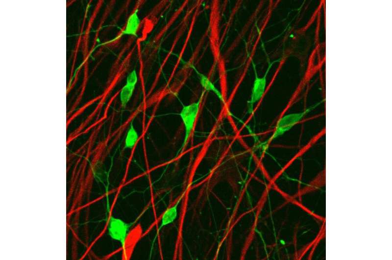 New anti-cancer therapy: Converting glioma cells into neurons
