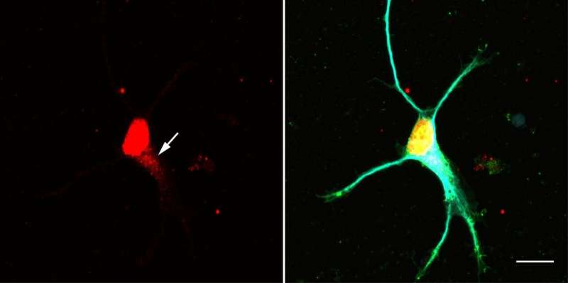 神经元中的新信号通路