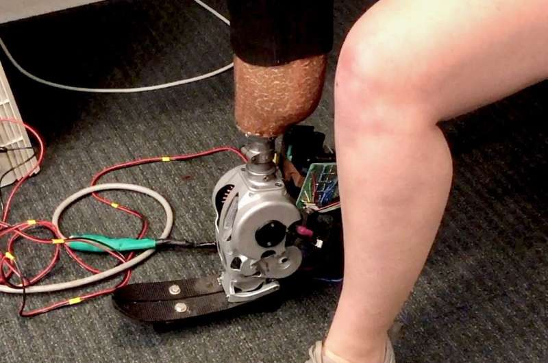 New surgery may enable better control of prosthetic limbs