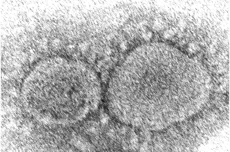 新的变体促进担心Covid-19病毒重新感染