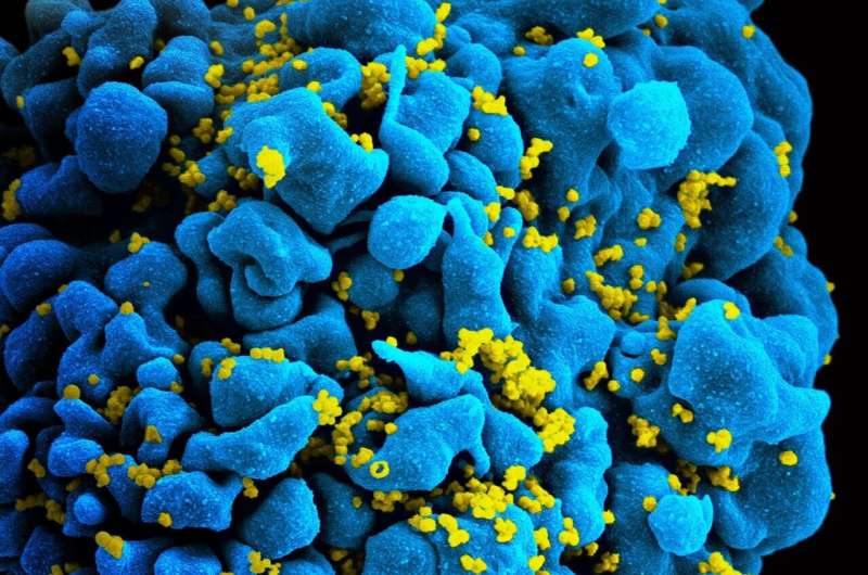 NIH researchers identify how two people controlled HIV after stopping treatment