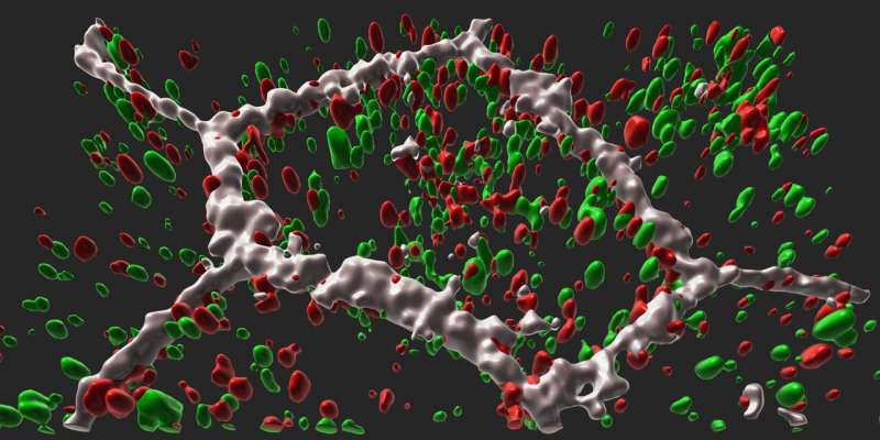 مطالعه NIH پیوند مولکولی را از ژن به انحطاط دیررس شبکیه نشان می دهد