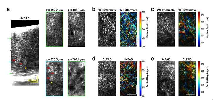 Noninvasive, label-free optical method visualizes deep, cellular brain disease in vivo