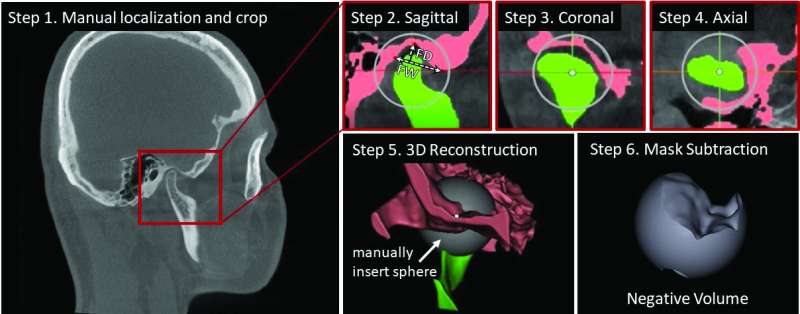 Novel approach to 3D image segmentation delivers ‘jaw-dropping’ demonstration