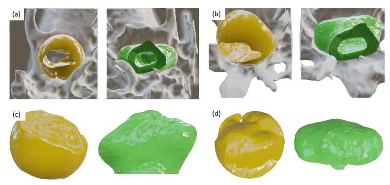 Novel approach to 3D image segmentation delivers 'jaw-dropping' demonstration