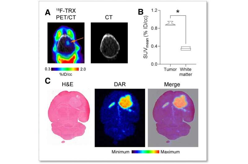 Novel imaging agent identifies biomarker for iron-targeted cancer therapies