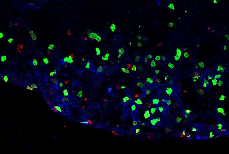 جمعیت سلول های ایمنی جدید ممکن است باعث التهاب در مولتیپل اسکلروزیس و سایر اختلالات مغزی شود