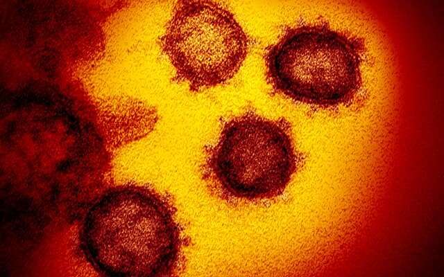 Novel coronavirus circulated undetected months before first COVID-19 cases in Wuhan, China